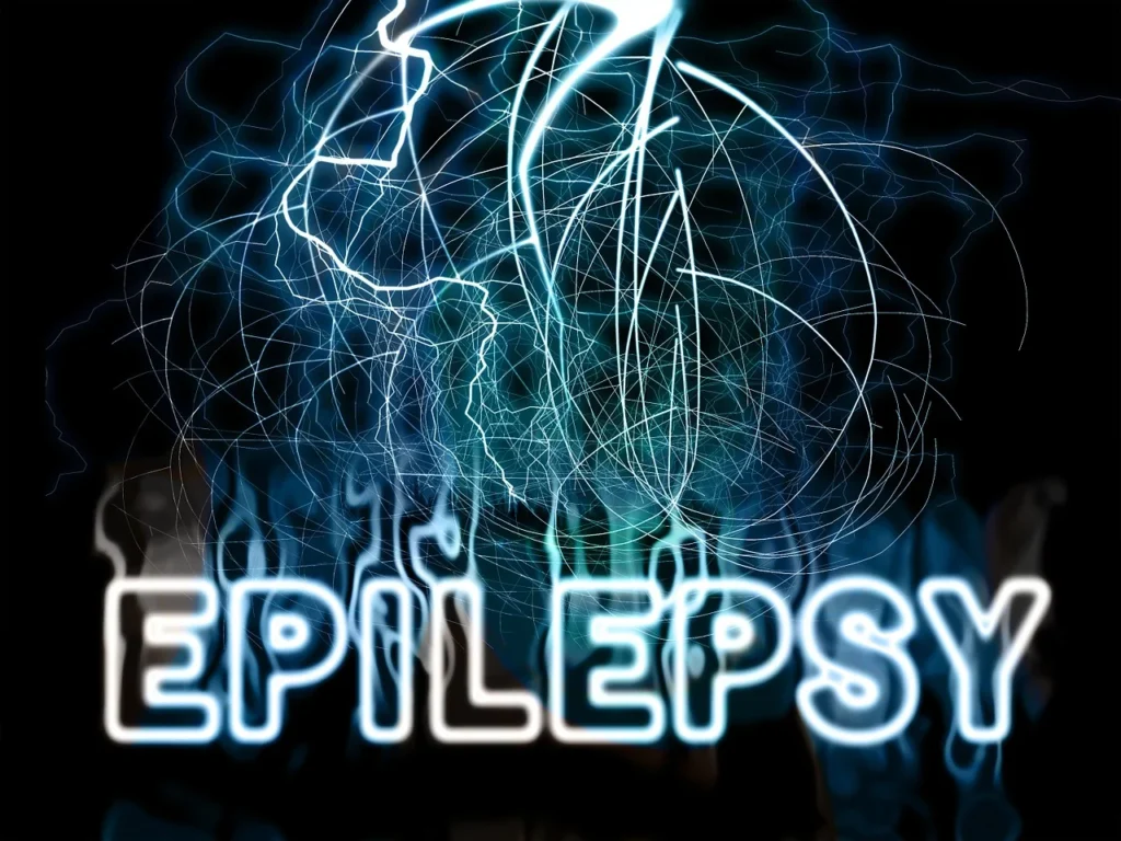 epilepsy /seizure