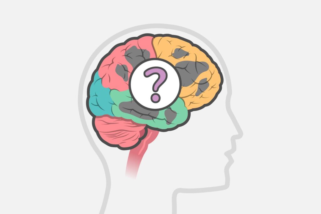 Vascular Dementia