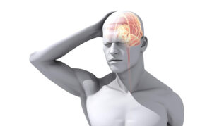 Tension Headaches: Causes, Symptoms & Treatments