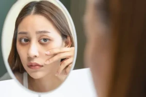 Cortisol Face: Is Stress Making Your Face Puffy?
