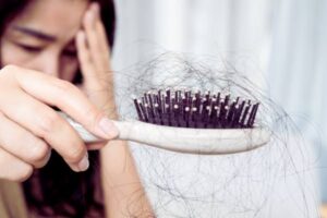 Stress Hair Loss: Causes, Signs & Recovery Timeline